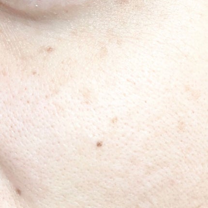 Grangrade薬用美白シミキールパックS /シーヴァ/洗い流すパック・マスクを使ったクチコミ(8枚目)