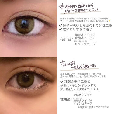 二重になる方法 ダブルアイリキッド Automatic Beautyの使い方や二重メイク 整形なし By 𝙠𝙖𝙡𝙞𝙣 乾燥肌 10代後半 Lips