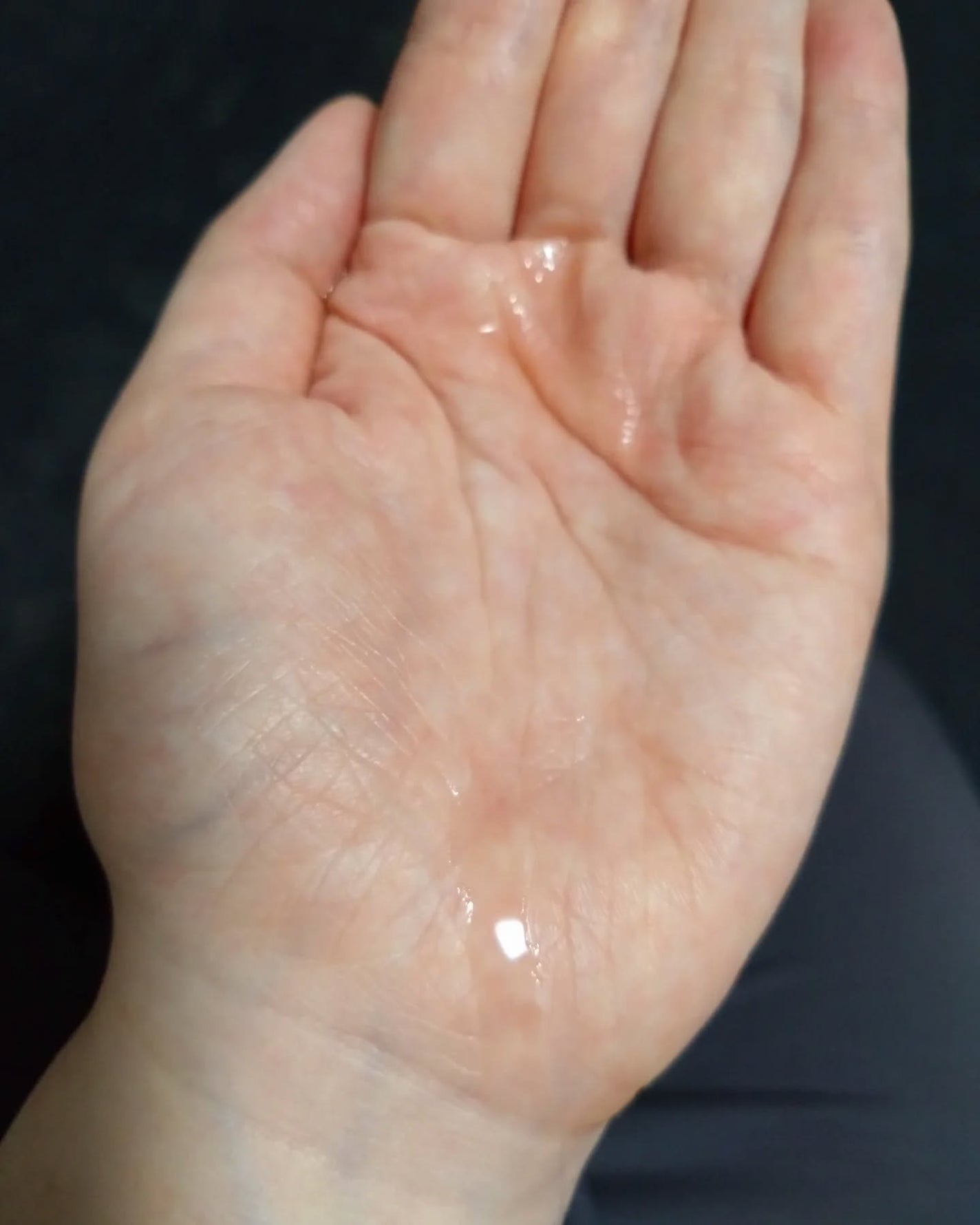 VC100エッセンスローション EX/ドクターシーラボⓇ/化粧水を使ったクチコミ(2枚目)