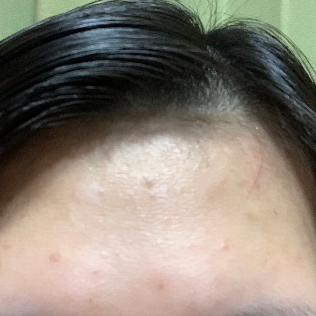 アルビオン 薬用スキンコンディショナー エッセンシャル/ALBION/化粧水を使ったクチコミ(2枚目)