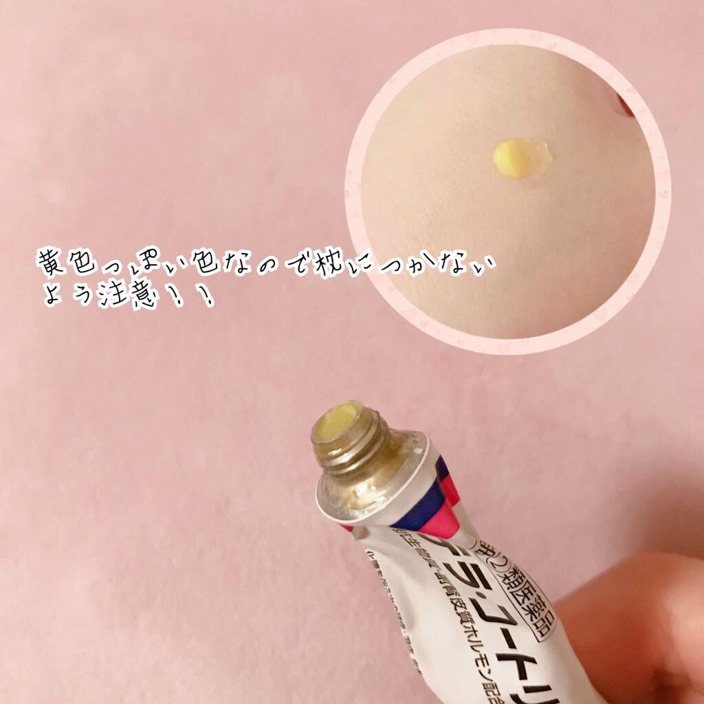 テラ コートリル 軟膏 医薬品 ジョンソン エンド ジョンソンの口コミ ニキビを早く治すために使っているものをご紹 By ヒナ 混合肌 Lips