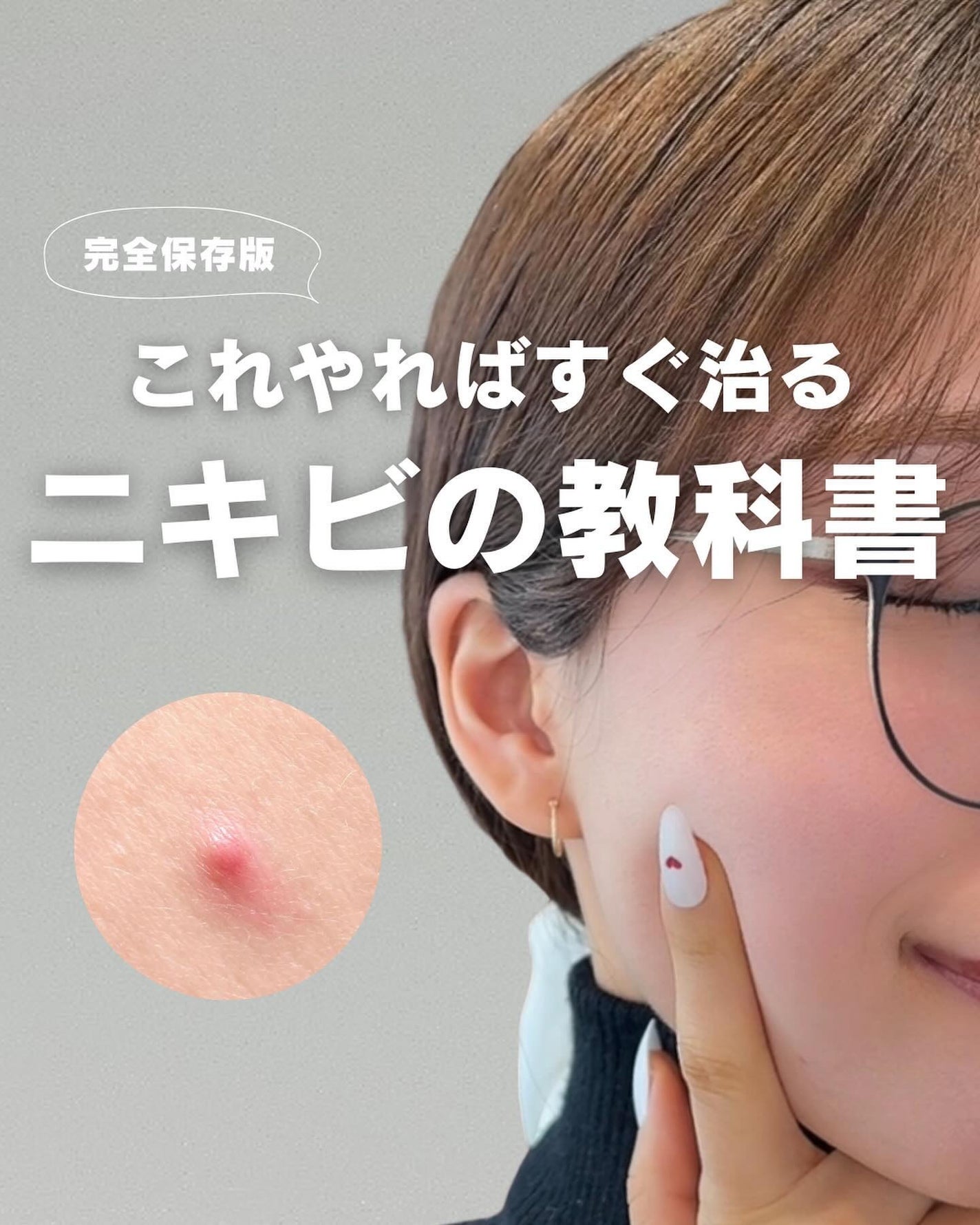 白湯(サユ) | ニキビと戦うOL🤍 on LIPS 「これ見ればOK!ニキビ改善の教科書📕ニキビって一括りにされる..」(1枚目)