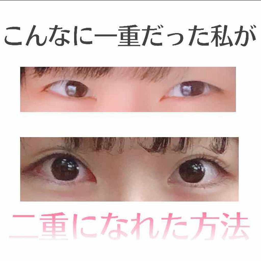 ふたえテープ 目立たず肌になじむ絆創膏タイプ/DAISO/二重まぶた用アイテムを使ったクチコミ(1枚目)