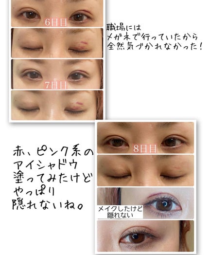 りっちゃん on LIPS 「土曜日の朝から目がたくさん出てきてすいません👀∞------..」(5枚目)