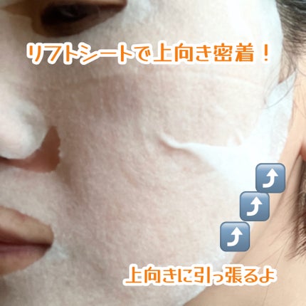 ルルルン ハイドラ V マスク/ルルルン/シートマスク・パックを使ったクチコミ(6枚目)