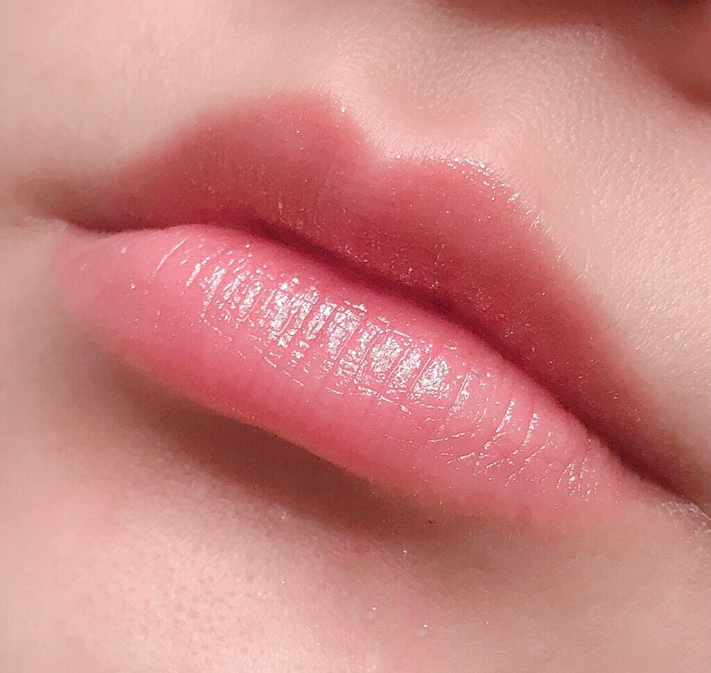 唇のニキビ予防におすすめのスキンケア15選|気になる原因からケア方法までご紹介のサムネイル