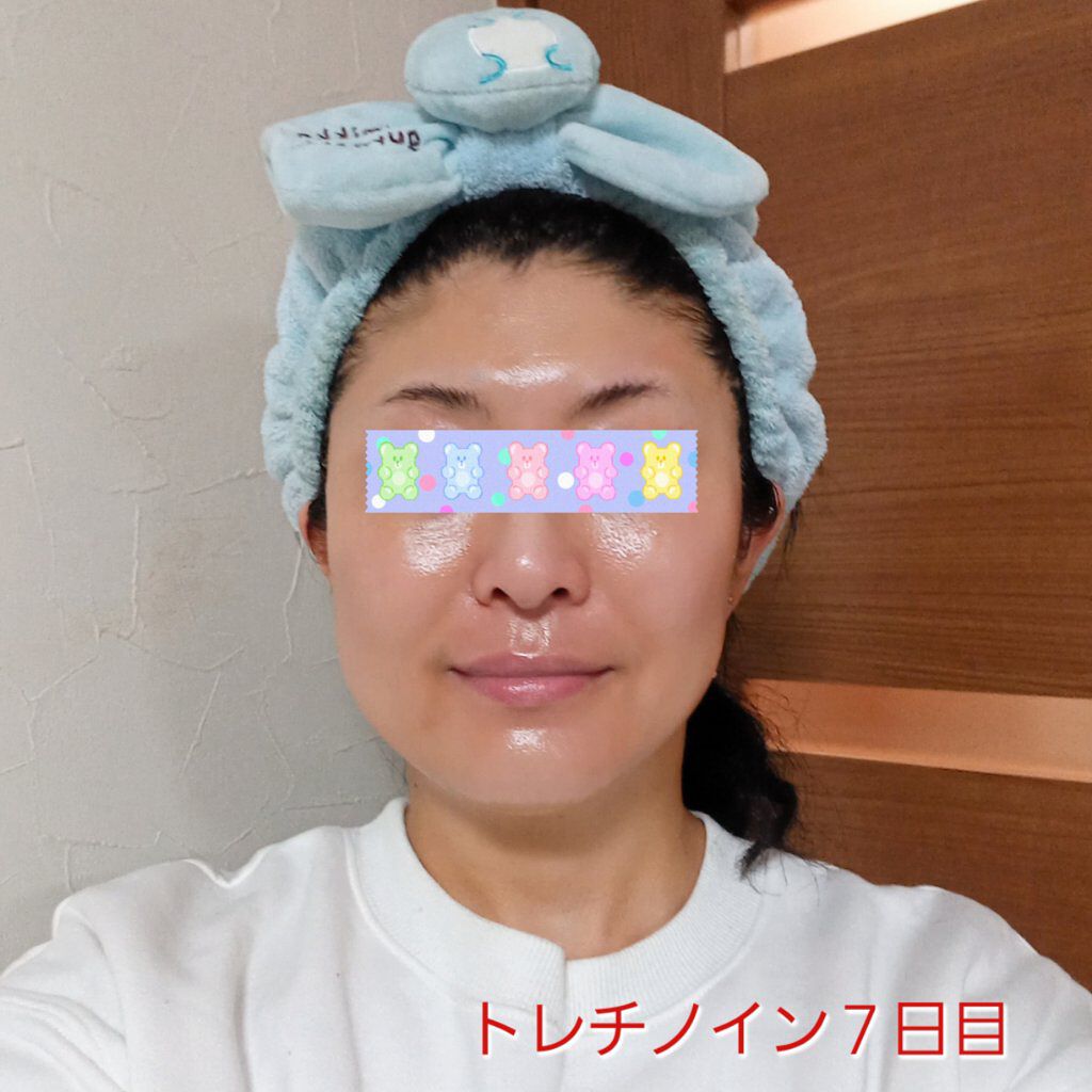 極潤α リフトクリーム/肌ラボ/フェイスクリームを使ったクチコミ（1枚目）