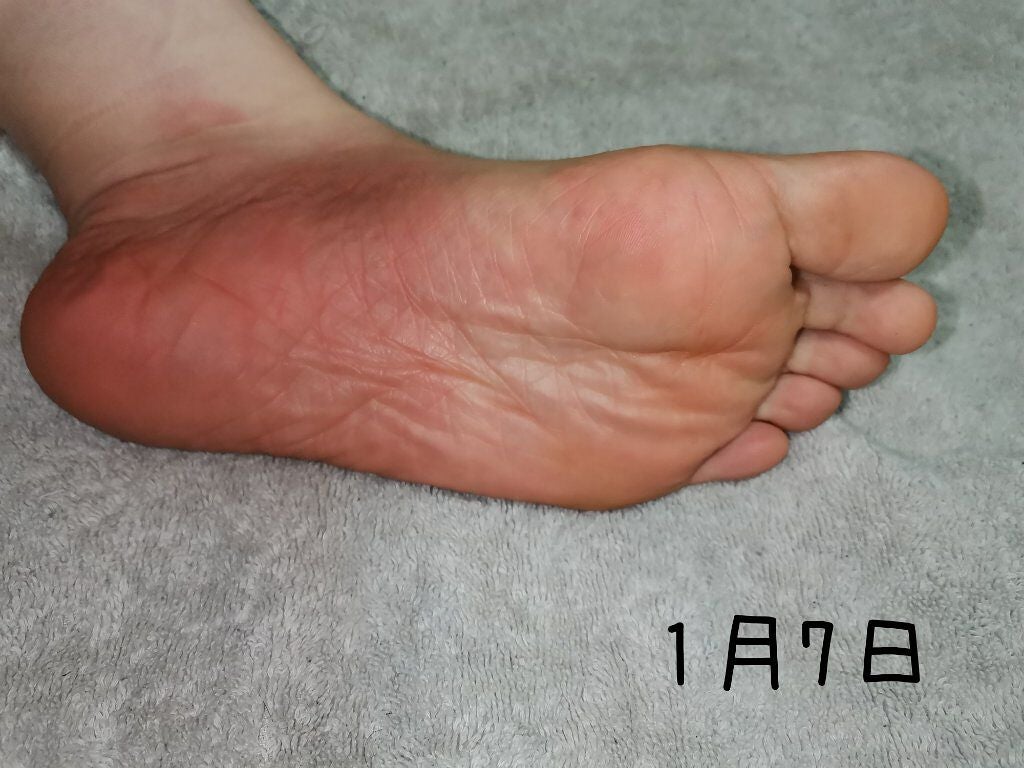 bea's up フットピーリングパック ペロリン グレープフルーツ/素数/レッグ・フットケアを使ったクチコミ(7枚目)