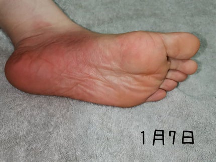 bea's up フットピーリングパック ペロリン グレープフルーツ/素数/レッグ・フットケアを使ったクチコミ(7枚目)