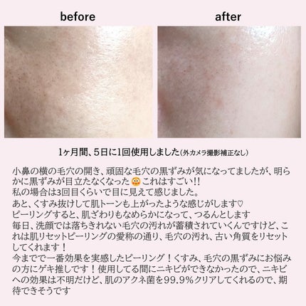 レッドアクネピーリングセラム/MEDICUBE/美容液を使ったクチコミ(4枚目)