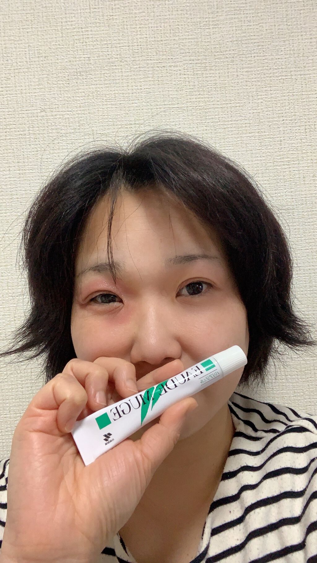 薬用集中バリアジェル/オードムーゲ/フェイスクリームを使ったクチコミ（1枚目）