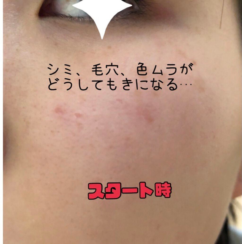 ミラミン/ZO Skin Health/フェイスクリームを使ったクチコミ(2枚目)