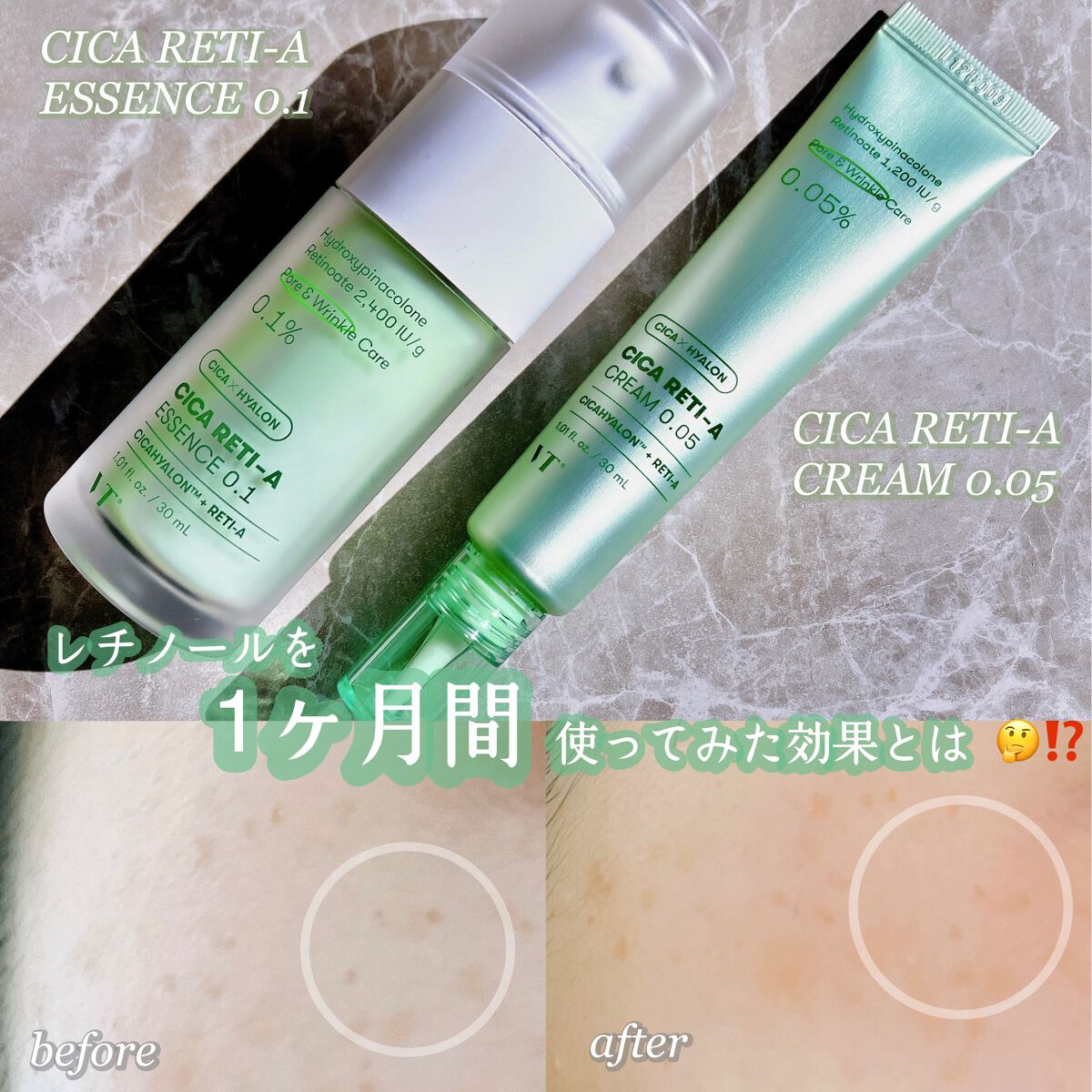 シカレチA エッセンス0.1/VT/美容液を使ったクチコミ（1枚目）