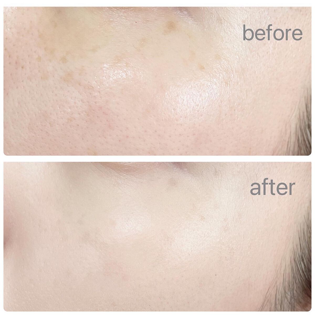 エアレスファンデーション/UMIKARA/クリーム・エマルジョンファンデーションを使ったクチコミ（3枚目）