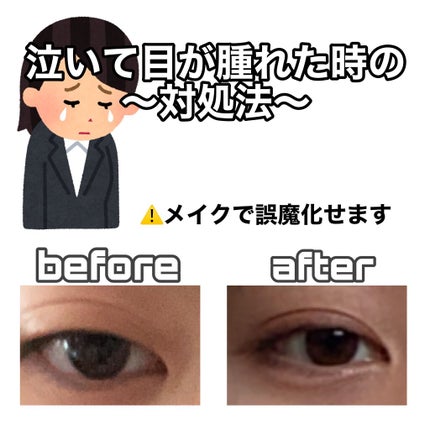 携帯用アイラッシュカーラー/無印良品/ビューラーを使ったクチコミ(1枚目)