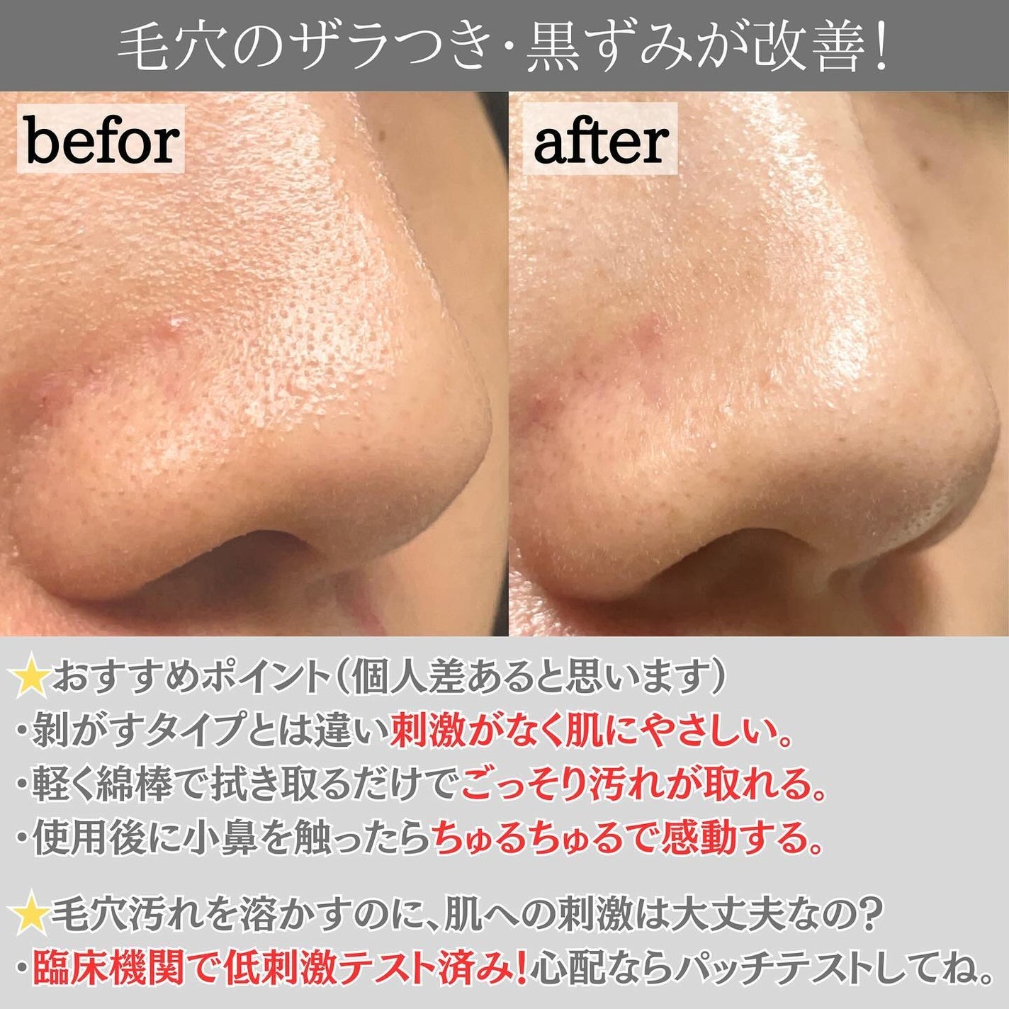 ナチュラルマイルドクリアノーズパック/ilso/シートマスク・パックを使ったクチコミ(5枚目)