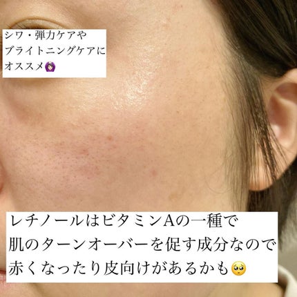 レチノールインテンシブ アドバンスドトリプルアクションアイクリーム/SOME BY MI/アイケア・アイクリームを使ったクチコミ(4枚目)