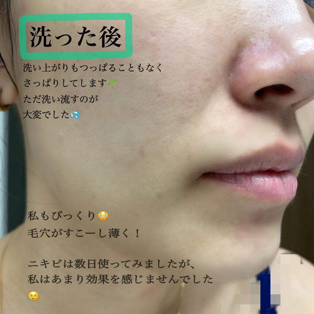 パワーマスク SP/ラッシュ/スクラブ・ゴマージュを使ったクチコミ(6枚目)