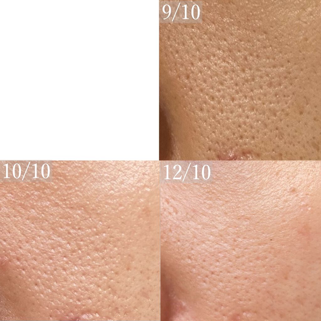 ビタピュアクト/HIDEMARI MEDICAL(ひでまりメディカル)/美容液を使ったクチコミ(3枚目)