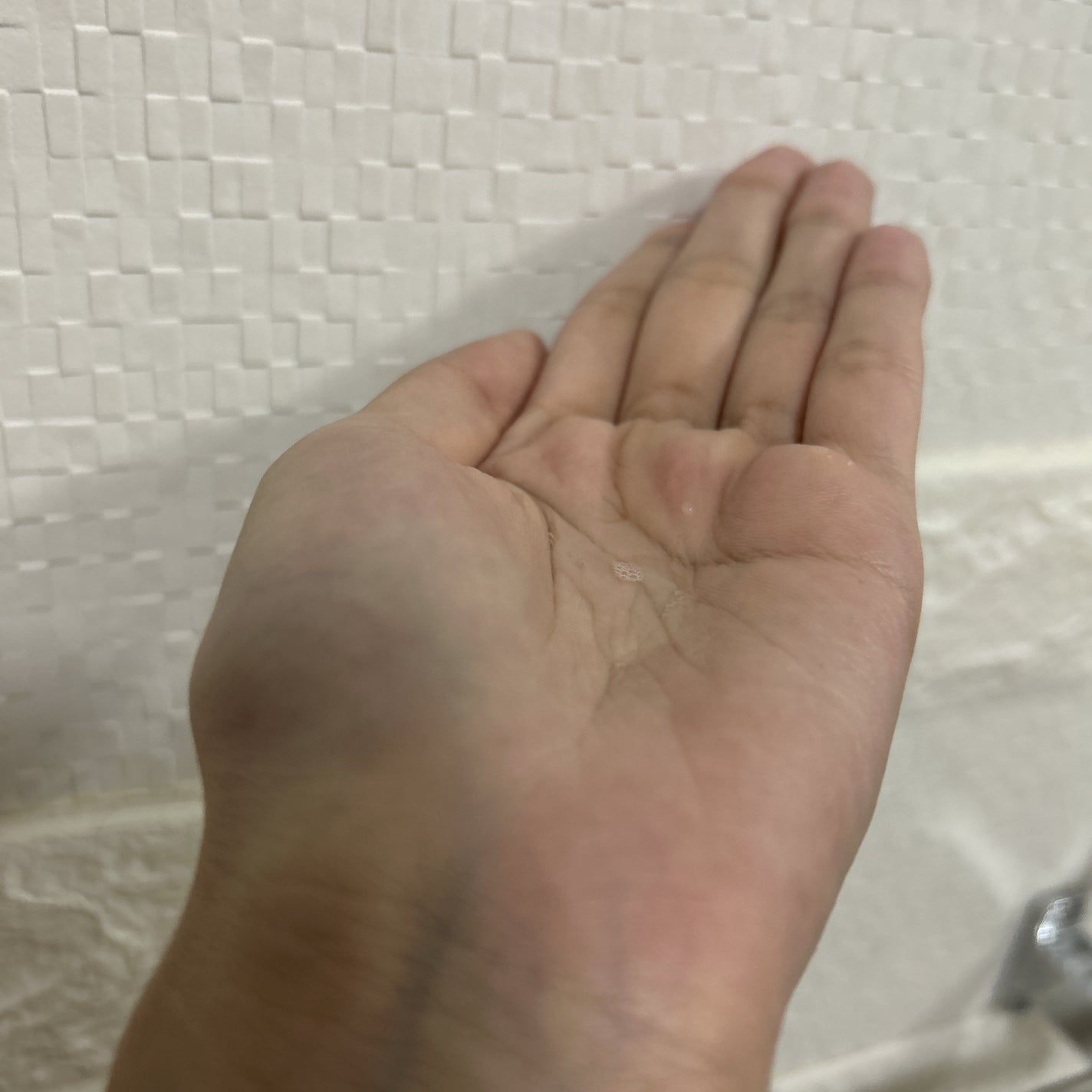 ACモイスト クリア ローション/iniks/化粧水を使ったクチコミ(2枚目)