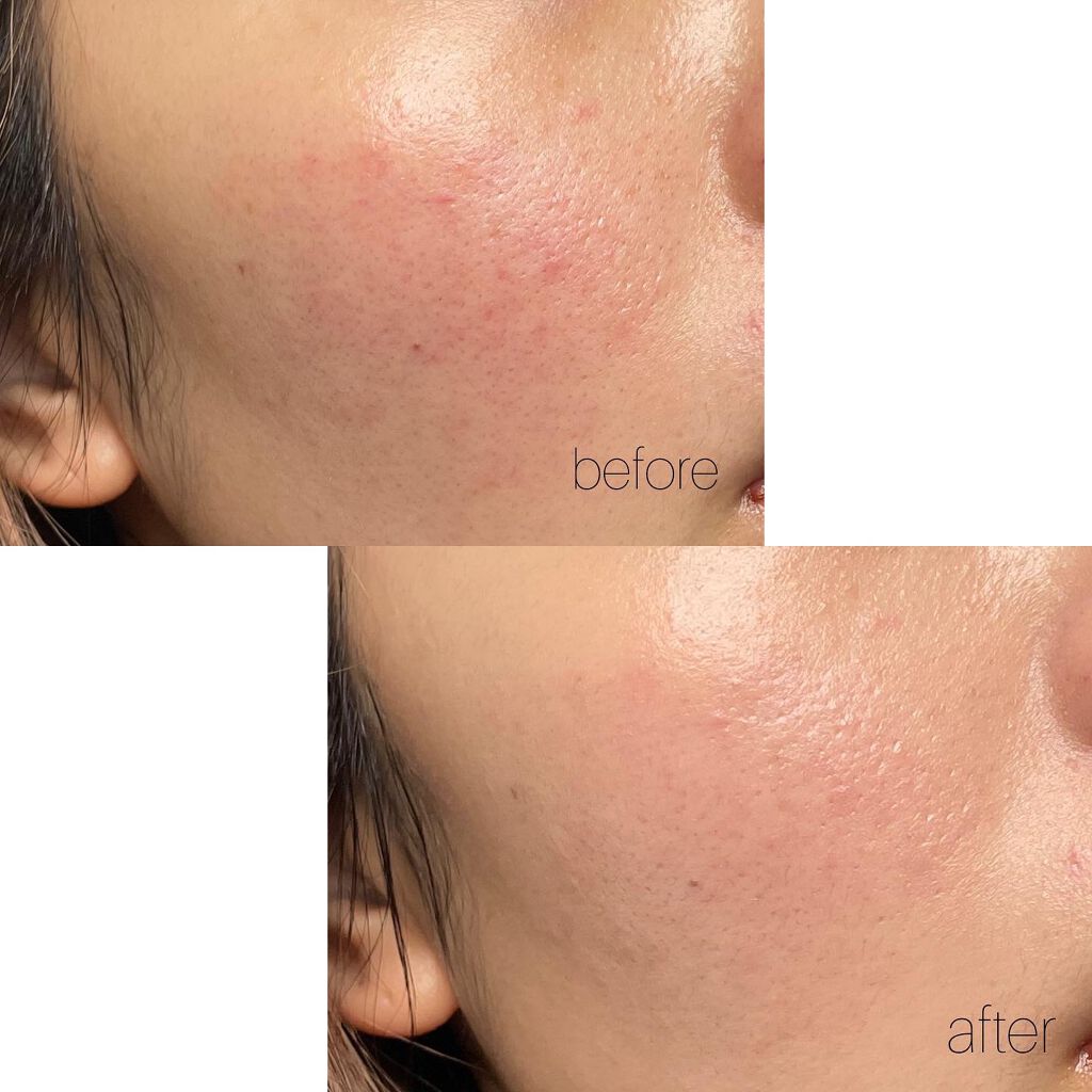 マスクフィットクッション/TIRTIR(ティルティル)/クッションファンデーションを使ったクチコミ(2枚目)