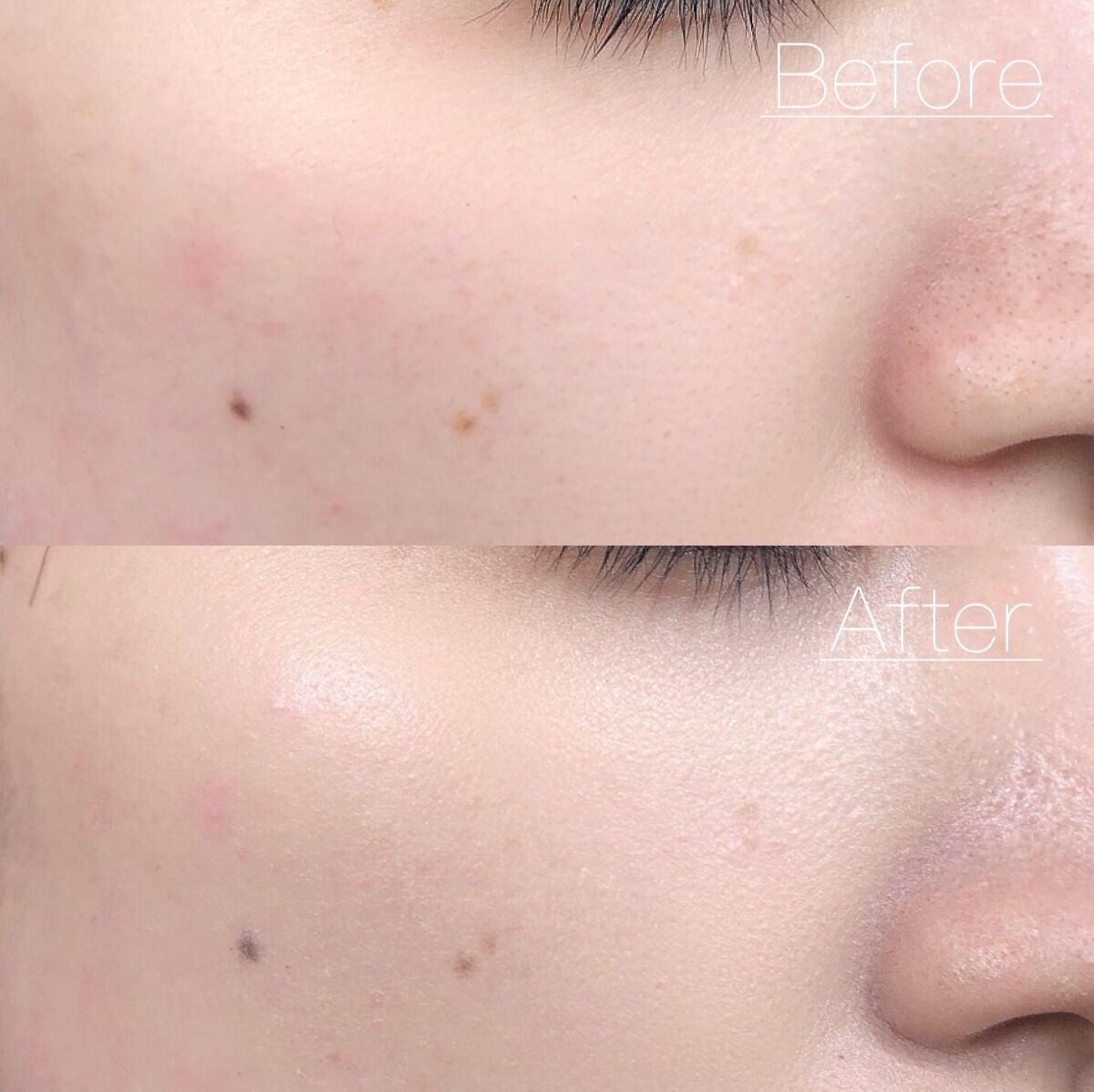 CICA エッセンススキンカバーパクト/VT/パウダーファンデーションを使ったクチコミ(6枚目)