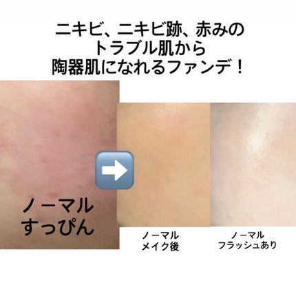 リアルカバーリキッド(ライトグロウ)/KATE/リキッドファンデーションを使ったクチコミ(1枚目)