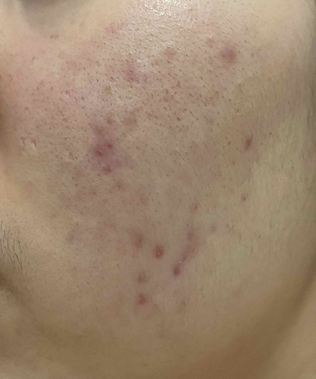 Cセラム/b.glen/美容液を使ったクチコミ（3枚目）