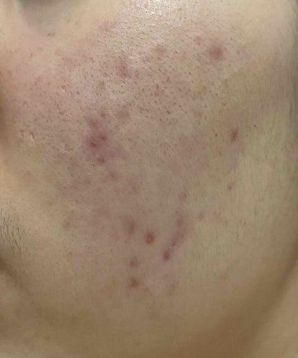 Cセラム/b.glen/美容液を使ったクチコミ(3枚目)