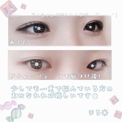 二重まぶた用シール/DAISO/二重まぶた用アイテムを使ったクチコミ(4枚目)