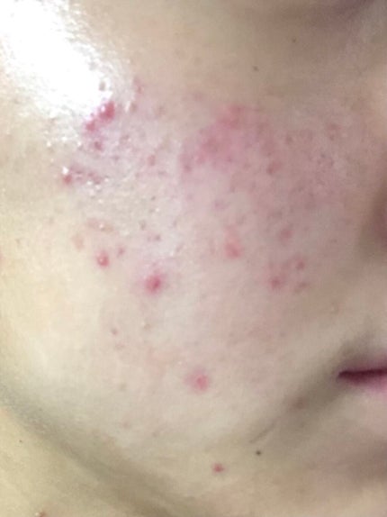 化粧水・敏感肌用・高保湿タイプ/無印良品/化粧水を使ったクチコミ(2枚目)