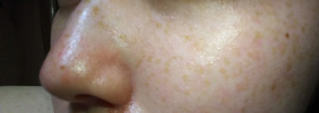 ピュアピンキークリーム/インフィックス/ボディクリームを使ったクチコミ(3枚目)