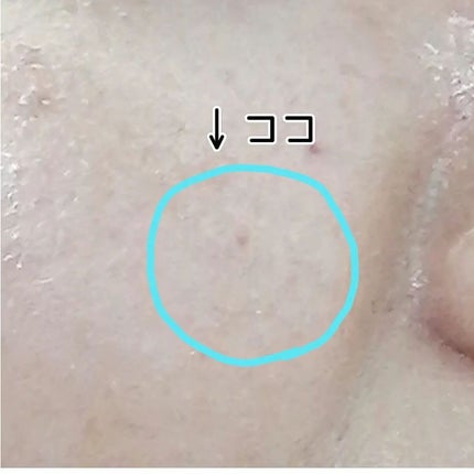 ごめんね素肌 キニナルマスク/クリアターン/シートマスク・パックを使ったクチコミ(9枚目)