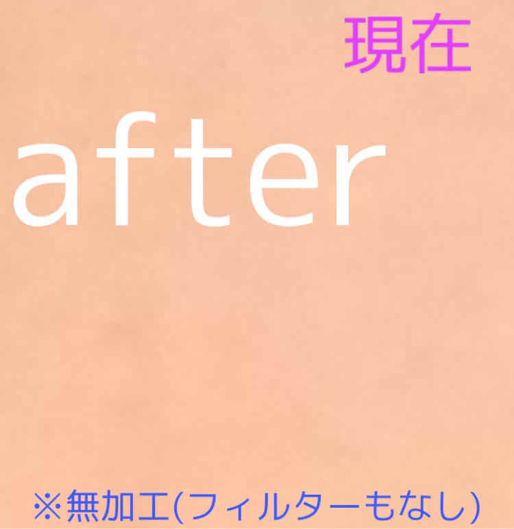 白潤 薬用美白化粧水/肌ラボ/化粧水を使ったクチコミ（3枚目）