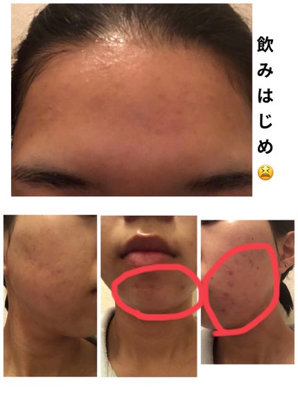 ネクステージ シー/POLA/健康サプリメントを使ったクチコミ(2枚目)