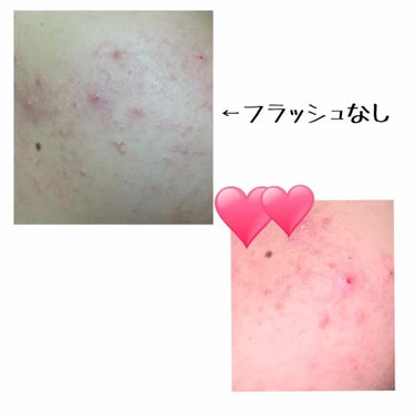 やょ🍑🤍 on LIPS 「急ですみません🙏🏻🙏🏻まじで悩みに悩んでます😭😭3枚目注意です..」（3枚目）