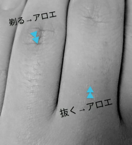 脱毛 ワックスシート/DAISO/除毛クリームを使ったクチコミ(3枚目)