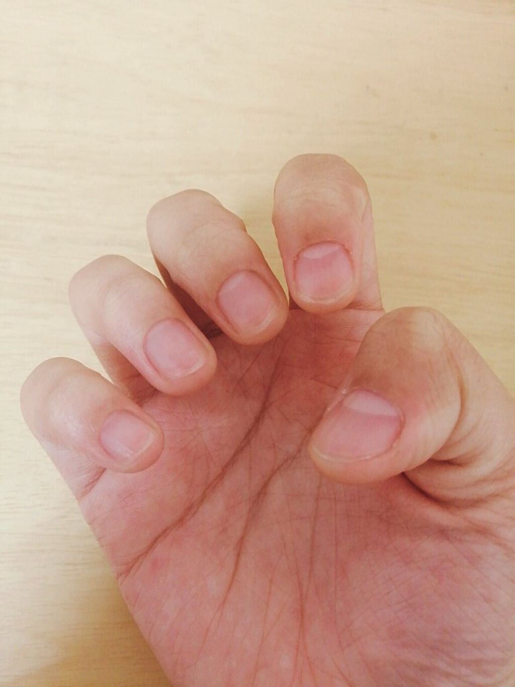 D.R on LIPS 「おはようございます٩(*´꒳`*)۶15日目の朝です!親指以外..」(3枚目)