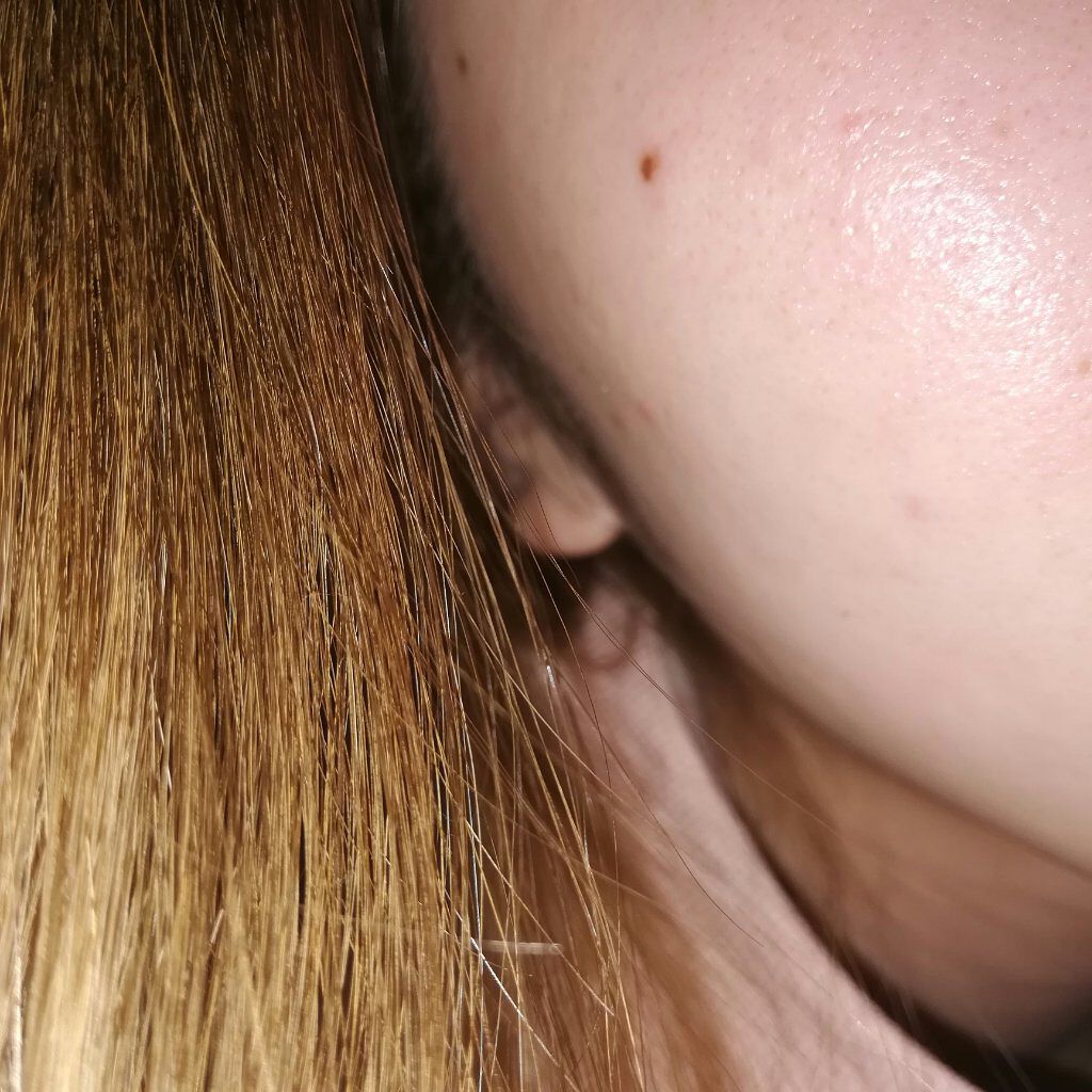 オードムーゲ 薬用ローション（ふきとり化粧水）/オードムーゲ/拭き取り化粧水を使ったクチコミ（1枚目）