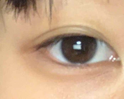 オロナインH軟膏 (医薬品)/オロナイン/その他を使ったクチコミ(3枚目)