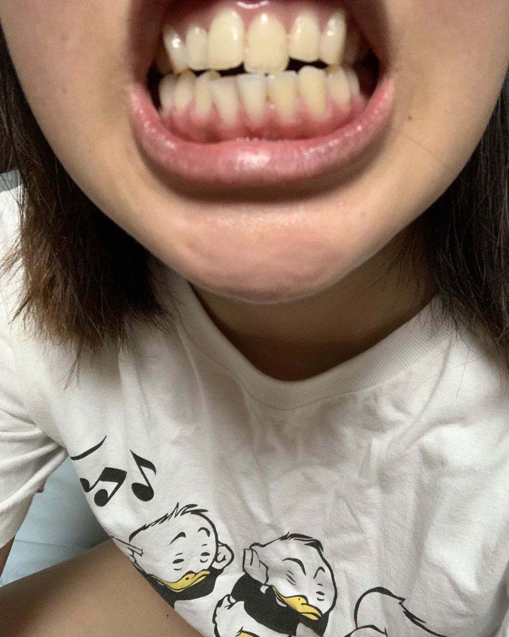 クレスト3Dホワイトニング ホワイトストリップ プロフェッショナル エフェクツ/クレスト/その他オーラルケアを使ったクチコミ（1枚目）