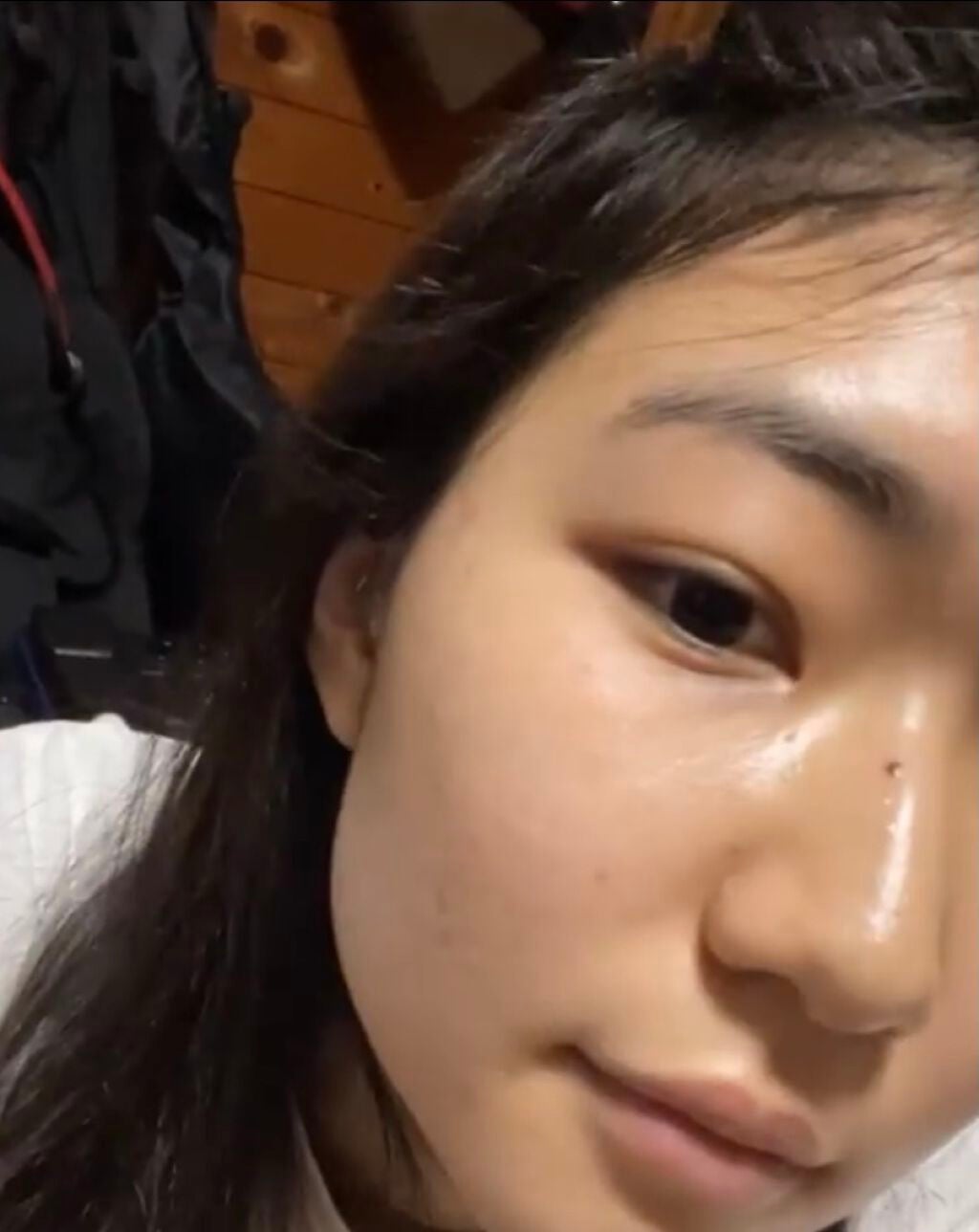 紫月 on LIPS 「汚い汚いと言われたお肌日記(1枚目→去年9月、2枚目→去年の1..」(3枚目)