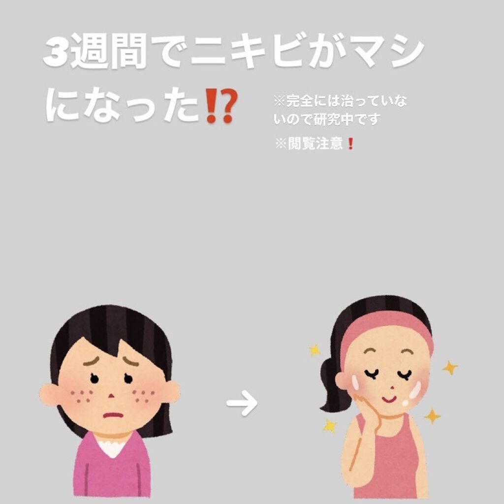 メンソレータムアクネス 薬用クリーム洗顔/メンソレータム アクネス/洗顔フォームを使ったクチコミ（1枚目）