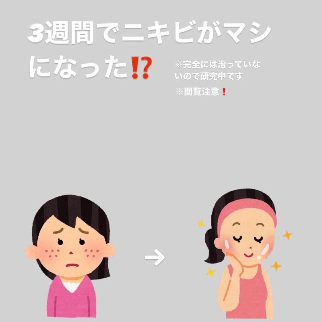 サミュ PHセンシティブクリーム/SAM'U/フェイスクリームを使ったクチコミ(1枚目)