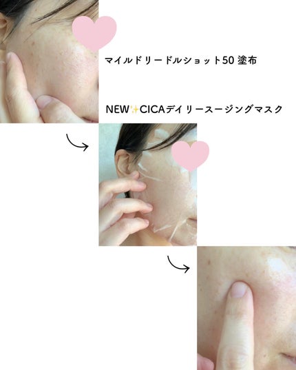 CICA デイリースージングマスク/VT/シートマスク・パックを使ったクチコミ(5枚目)