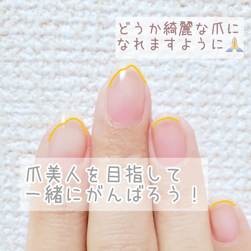 エテュセ クイックケアコート/ettusais/ネイルオイル・トリートメントを使ったクチコミ(3枚目)