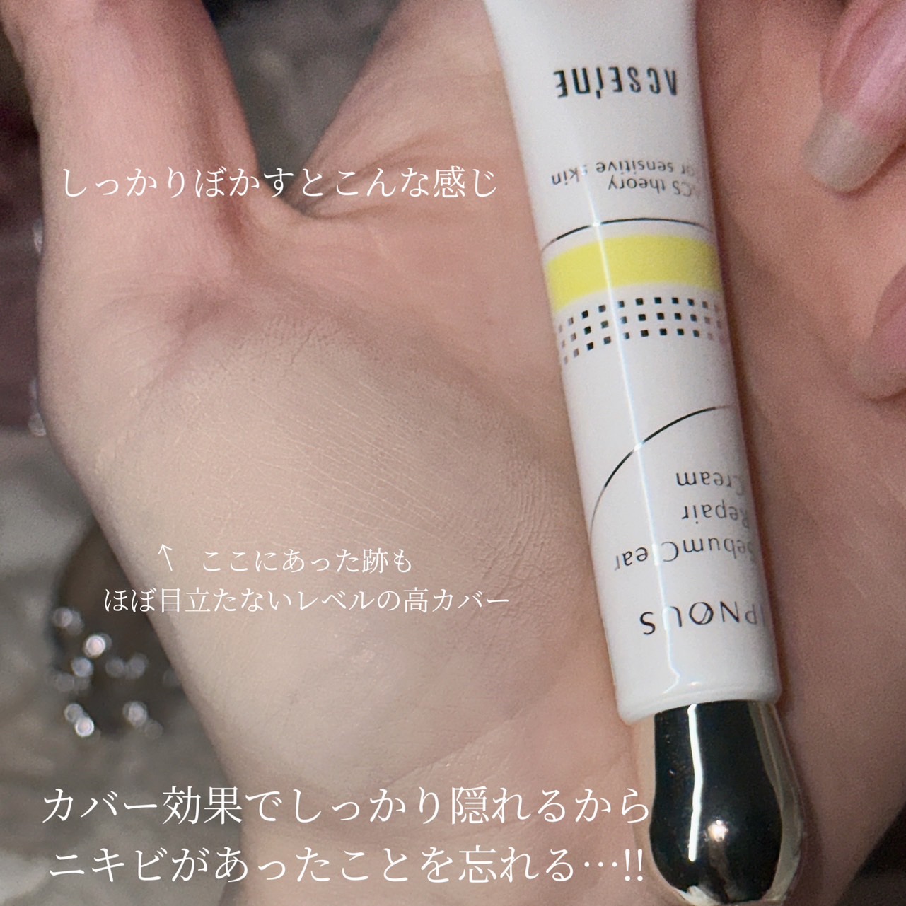 イプノス シーバムクリア リペアクリーム/ACSEINE/フェイスクリームを使ったクチコミ（3枚目）