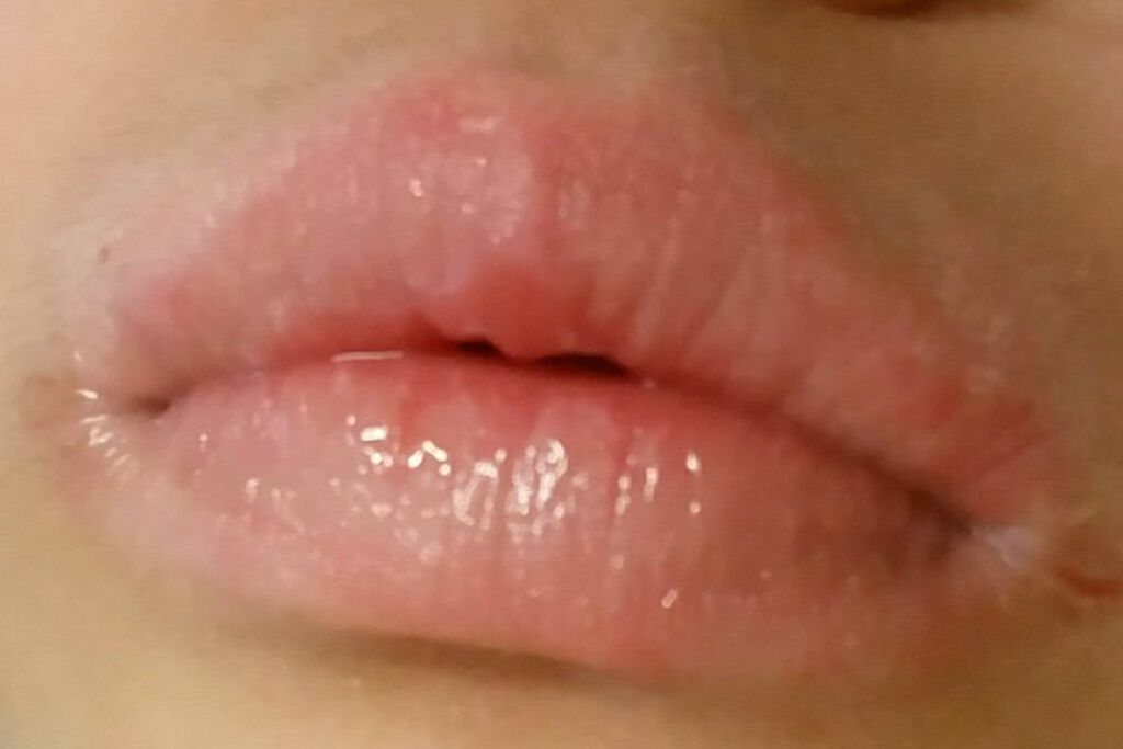 リップモイストエッセンス/DAISO/リップ美容液を使ったクチコミ（3枚目）