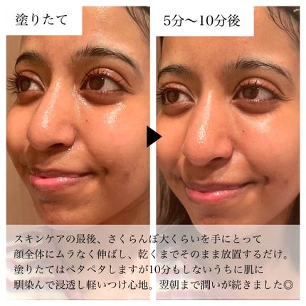 フルモア ピールナイトジェル/FRU MOR/フェイスクリームを使ったクチコミ(7枚目)