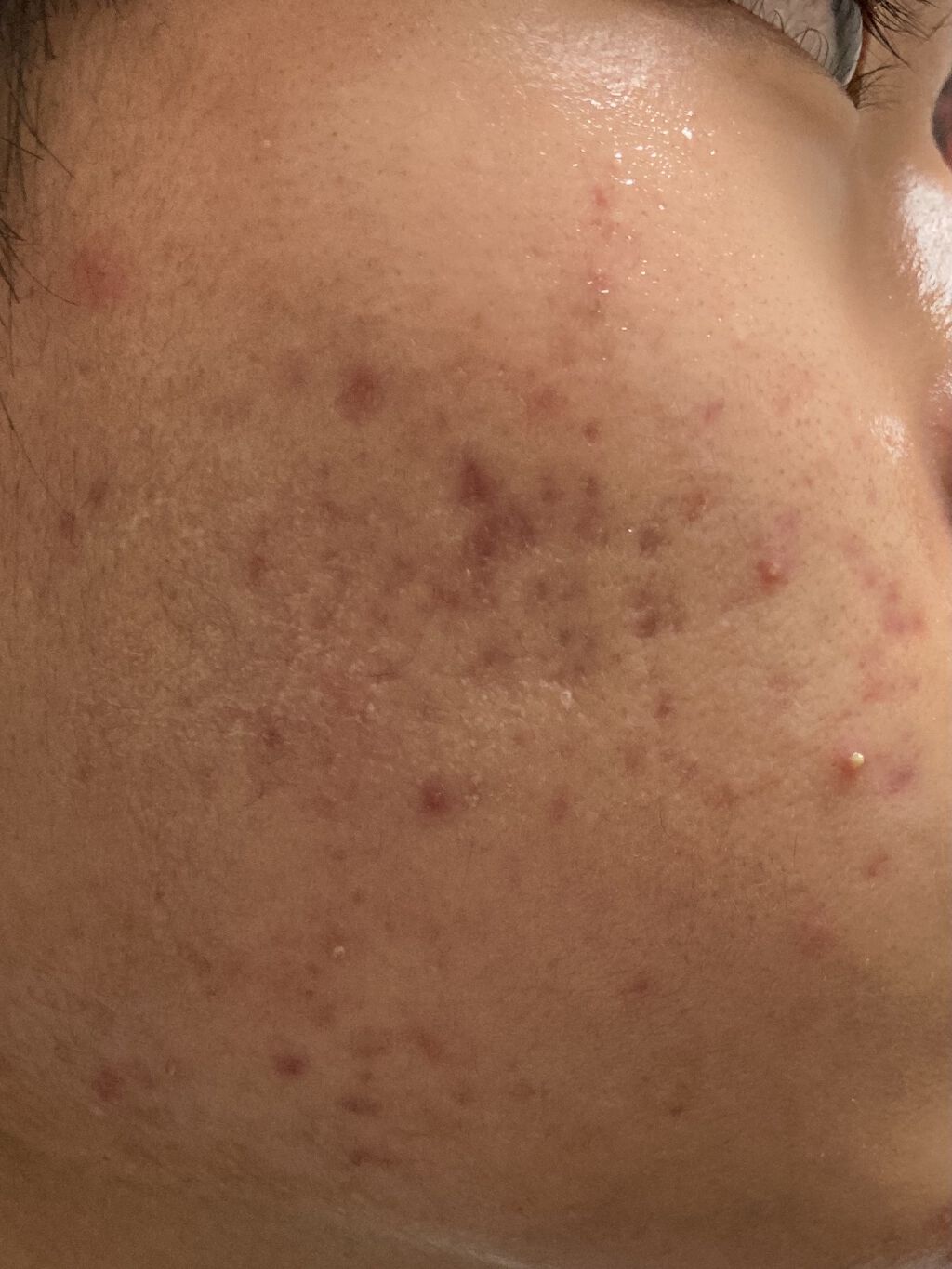 白色ワセリン(医薬品)/健栄製薬/その他を使ったクチコミ（2枚目）